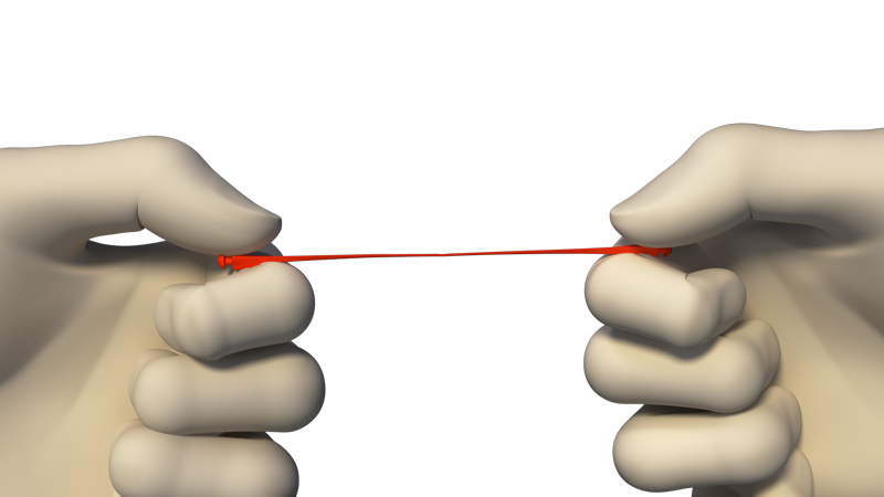 One-Visit-Crown-OVC3-Stretching-stretch-wedge OVC3 Stretch Stretch Wedge